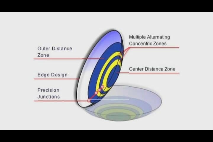 how do contact lenses work