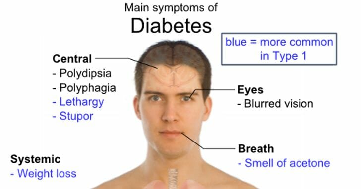 diabetes common symptoms