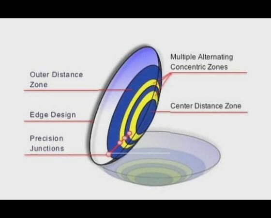 How Do Contact Lenses Work