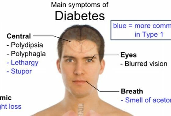 The Relationship Between Diabetes and Eye Problems