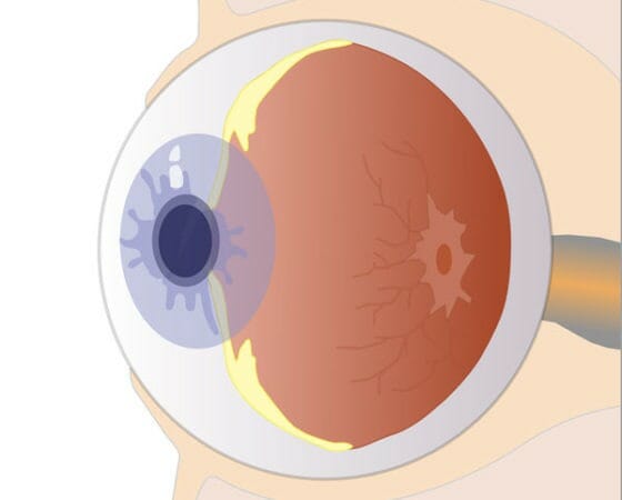 Understanding How the Human Eye Works